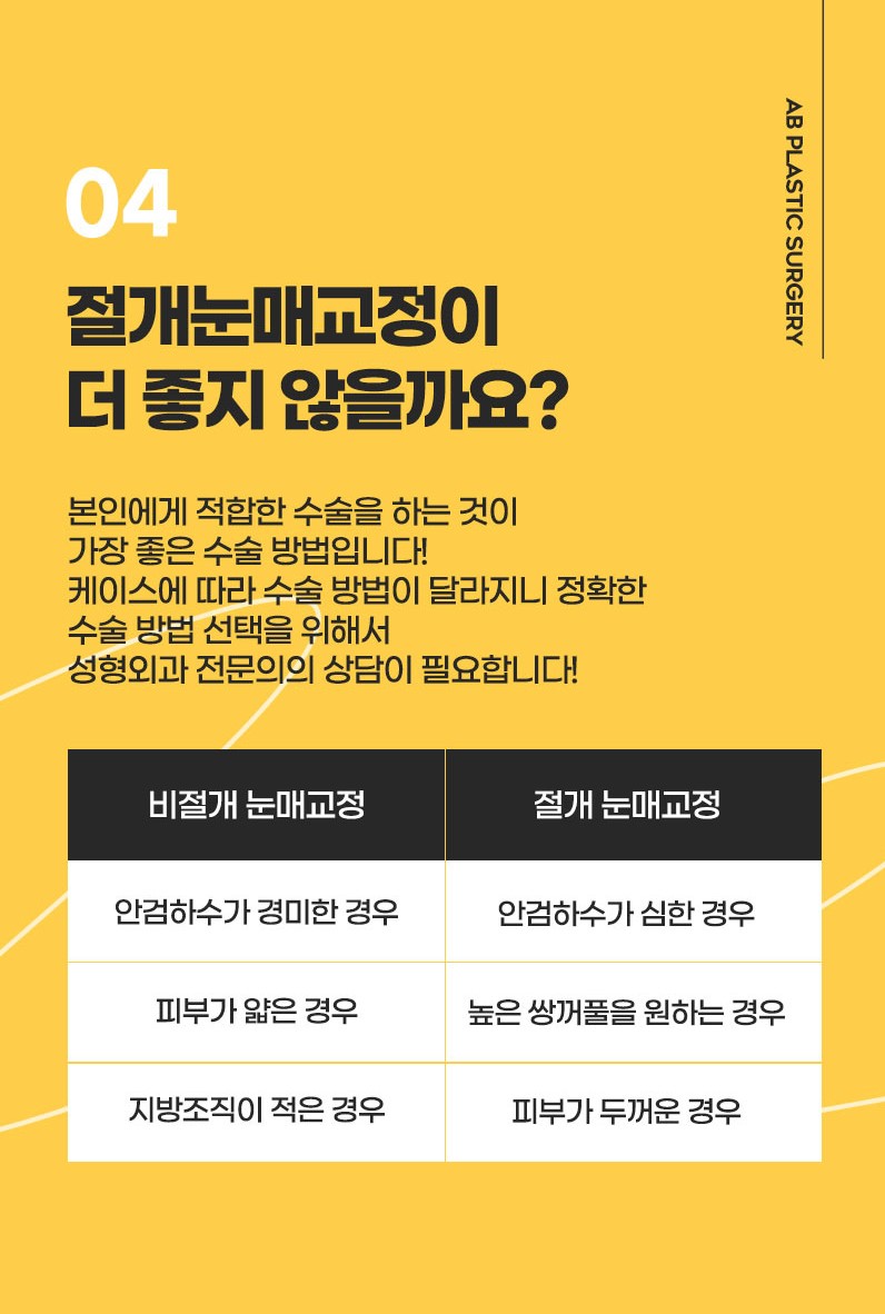AB성형외과와 눈매교정수술전후 비교해보세요! 관련 이미지 7