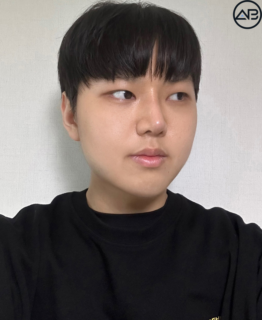 에이비성형외과 맥미남(MAKE미남) 방송이후 근황_가슴앓이내남자 관련 이미지 7