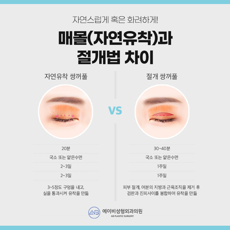 쌍꺼풀수술 자연유착 매몰법 VS 절개법 차이 관련 이미지 3