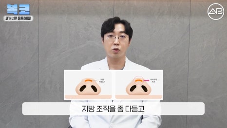 #에이비성형외과#에이비tv#코성형#복코성형 관련 이미지 11
