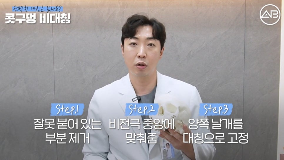 #에이비성형외과#에이비tv#코성형#콧구멍비대칭 관련 이미지 8
