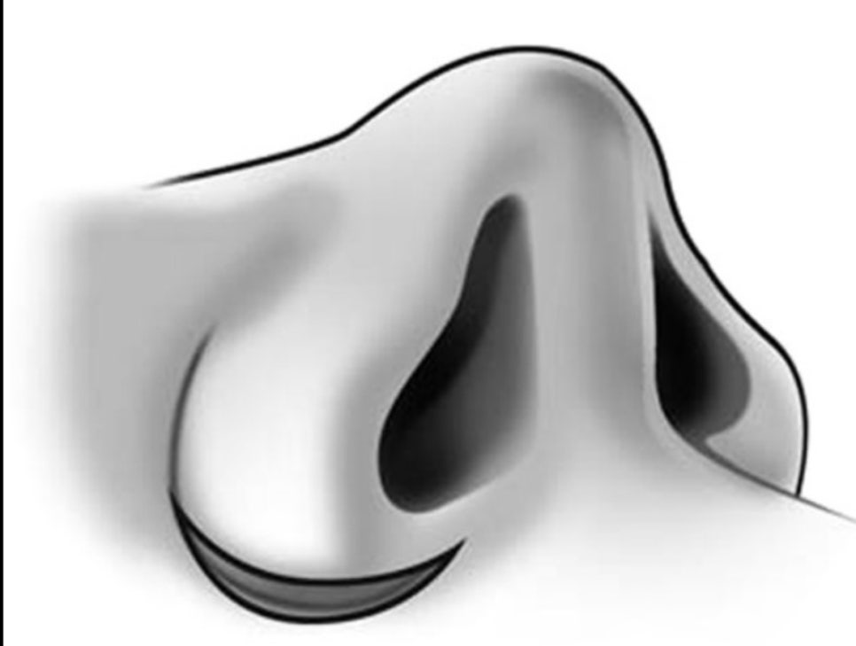 Q. I only want to have alar reduction, but the medial and lateral incision methods seem different. What exactly is the difference? image 2