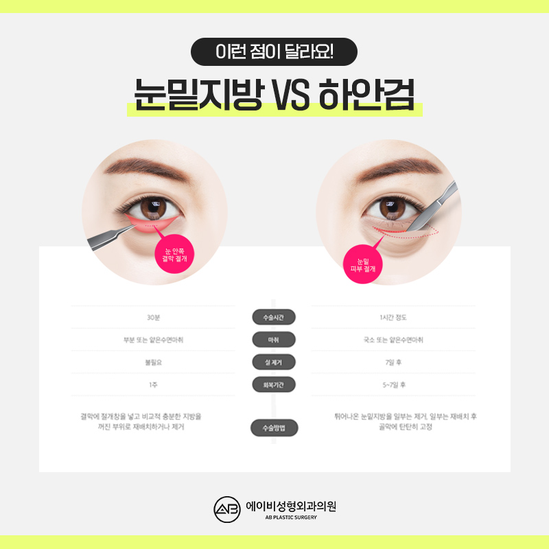 눈밑지방재배치수술 제대로 알고하자 관련 이미지 4