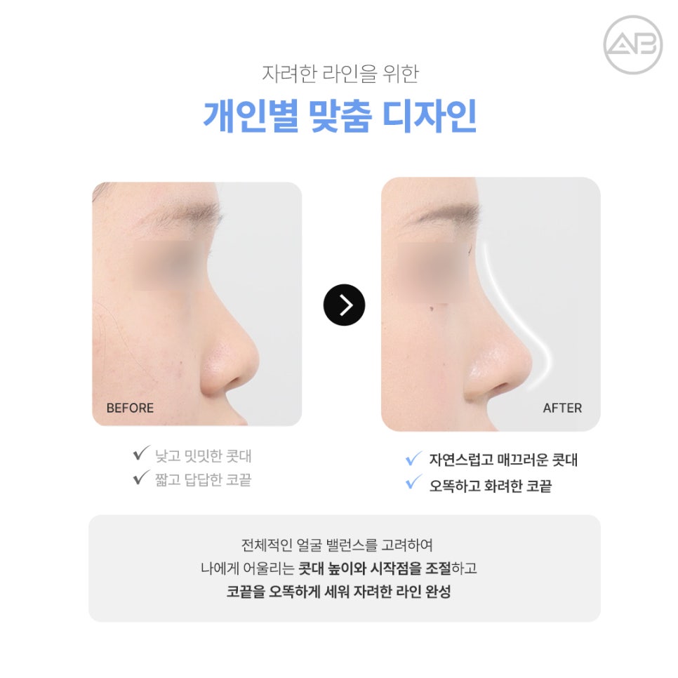 What Are the Special Points of AB Plastic Surgery’s Stylish Nose Surgery? image 5