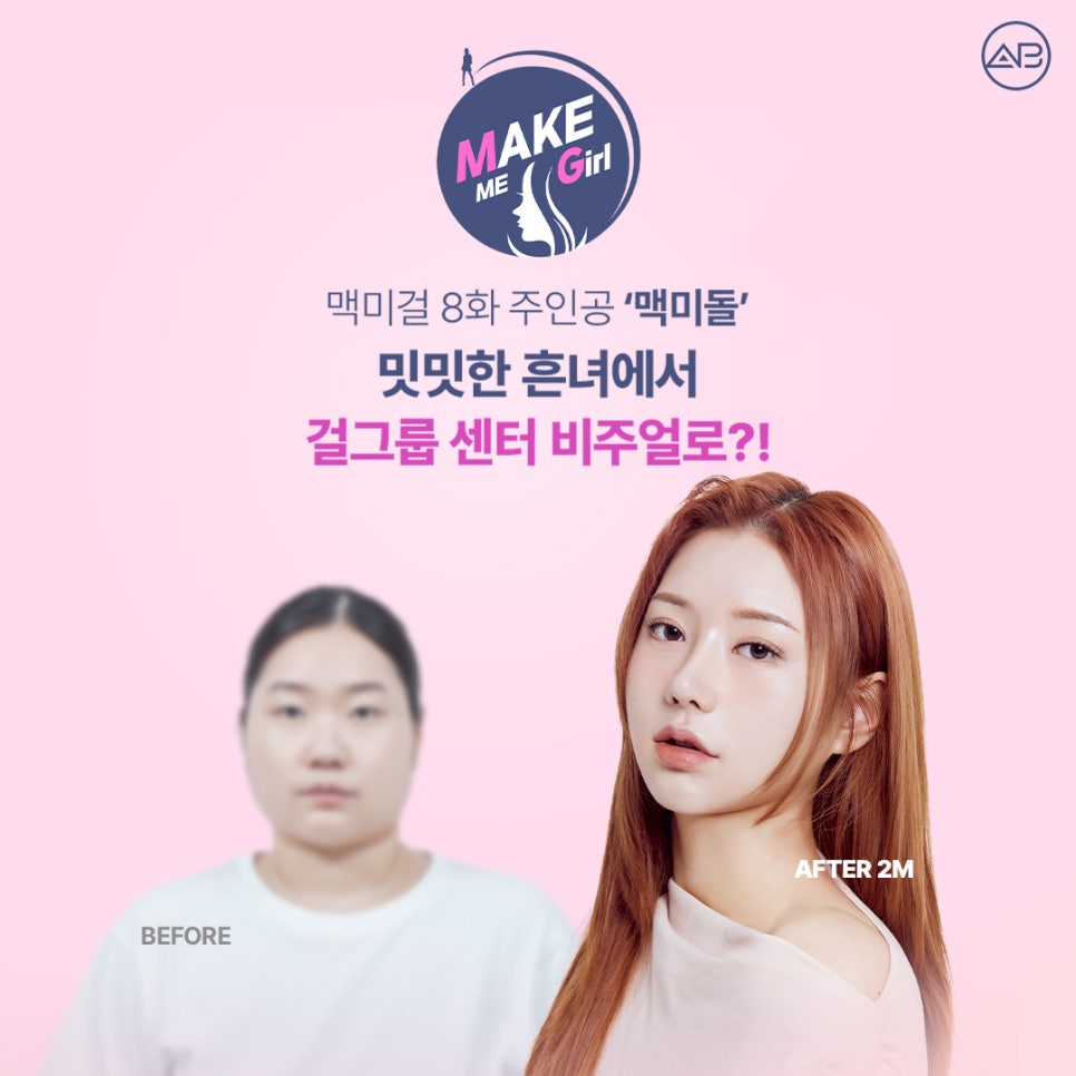 AB Plastic Surgery Make Me Girl (MAKEMEGirl) Episode 8: Makemidol Nose Surgery Review image 1