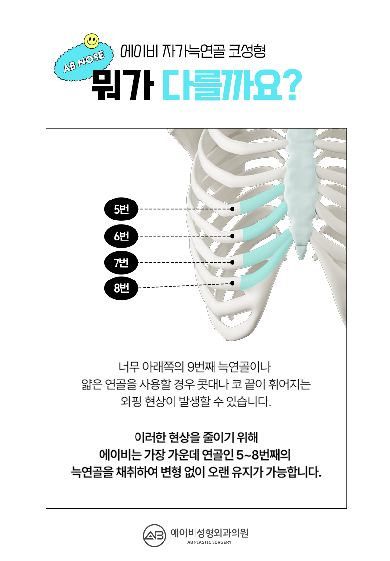 At AB Plastic Surgery, where there is extensive experience with autologous rib cartilage rhinoplasty image 2