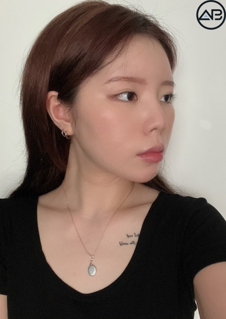 AB성형외과 예쁜애 옆에 예쁜애 후기 모음집 관련 이미지 3
