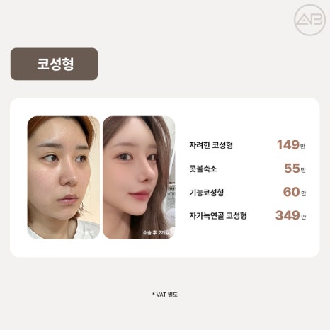 AB Plastic Surgery 5th Anniversary Event and 49% Discount Event image 6