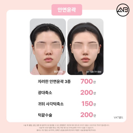 에이비성형외과 설렘 가득 봄 한정 49% 할인 이벤트 관련 이미지 9