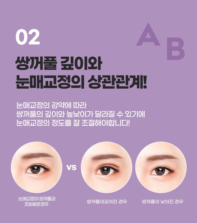 AB성형외과와 눈매교정수술전후 비교해보세요! 관련 이미지 5