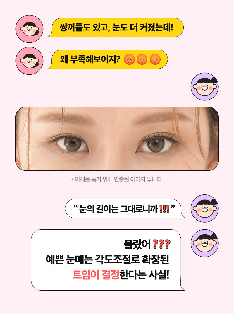 What It Looks Like Before and After Canthoplasty image 2