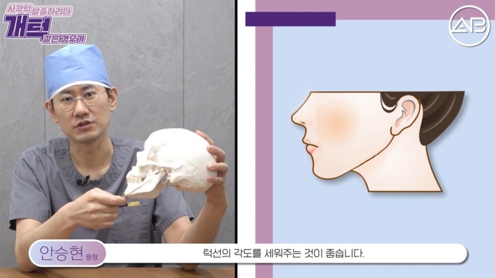 #에이비성형외과#에이비tv#안면윤곽#사각턱 관련 이미지 4