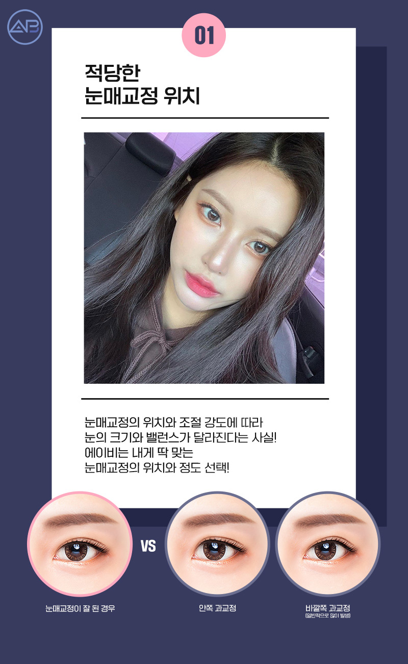 눈매교정수술후기 에이비성형외과에서 확인해 관련 이미지 3