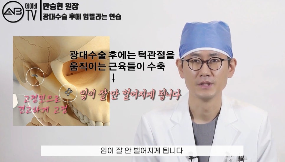 #에이비성형외과#에이비TV#광대수술#입벌리기운동 관련 이미지 2