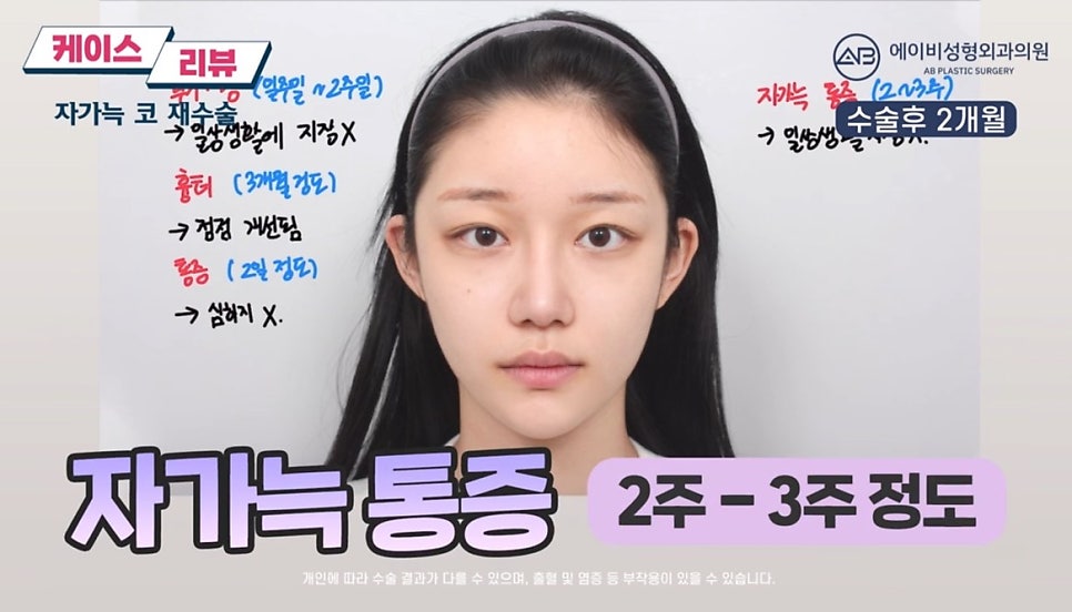 #에이비성형외과#에이비tv#케이스리뷰#코성형#코재수술 관련 이미지 7
