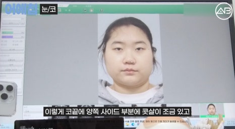 에이비성형외과 맥미걸(MAKEMEGirl) 맥미돌 코성형 상담 과정 관련 이미지 1