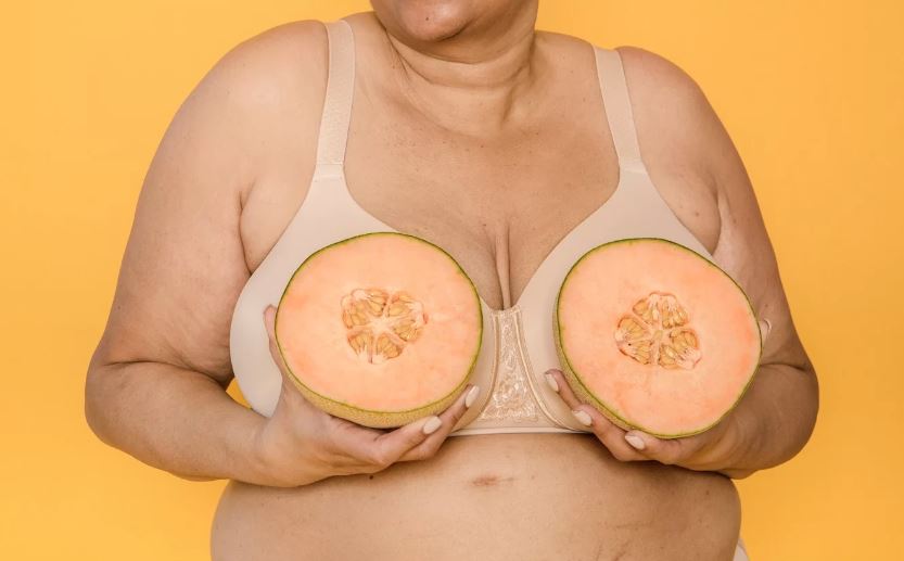 [Breast Reduction Surgery] I Want to Know Where Scars Form on the Breast.. image 5