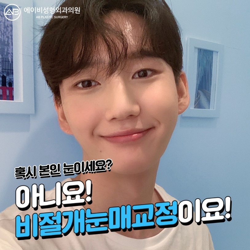 [칼럼] 짝눈인데, 한쪽만 수술받아도 괜찮을까요? 관련 이미지 3