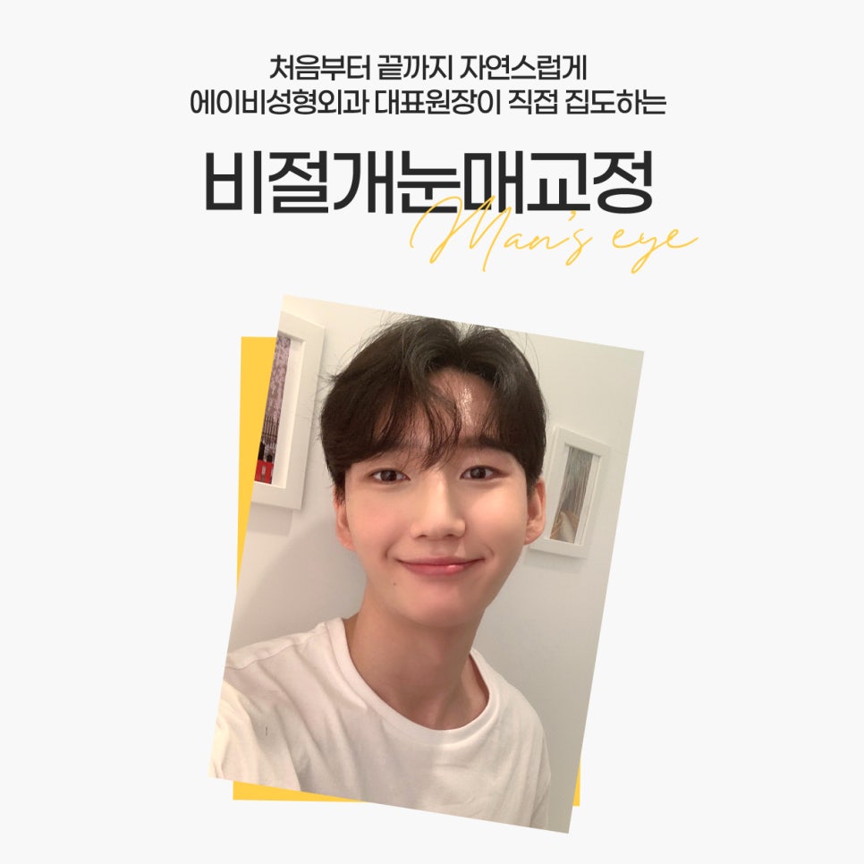 [칼럼] 쌍꺼풀 없이, 눈매교정만 할 수는 없나요? 관련 이미지 4