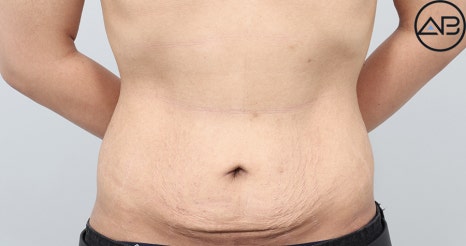 AB Plastic Surgery, MAKEmiNamn Broadcast Afterlife Update_방구석내남자 image 9