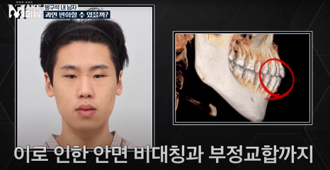 [AB Plastic Surgery Featured on Broadcast] LG HelloVision & KBSjoy image 10
