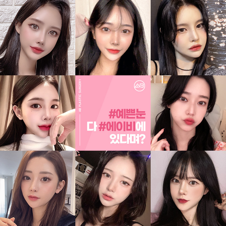 눈재수술유명한곳 하면 에이비성형외과 아닐까 관련 이미지 5