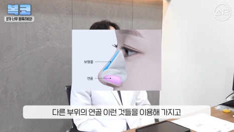 #에이비성형외과#에이비tv#코성형#복코성형 관련 이미지 9