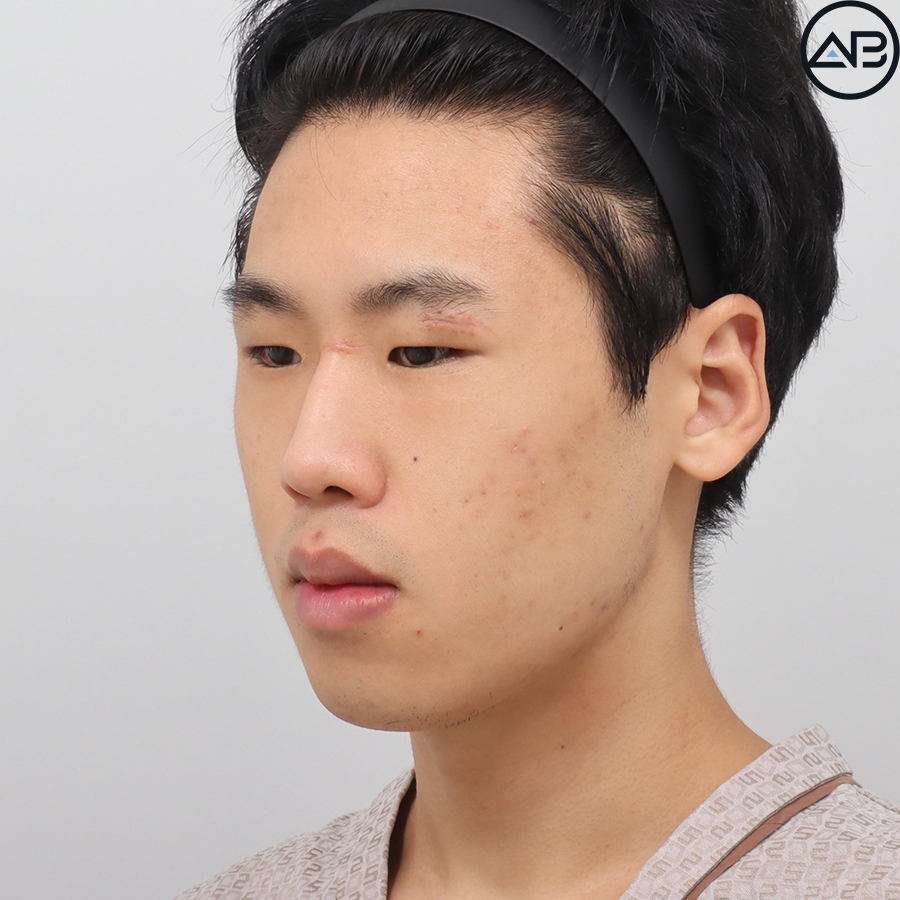 AB Plastic Surgery, MAKEmiNamn Broadcast Afterlife Update_방구석내남자 image 2