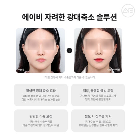 자연스럽고 조화로운 자려한안면윤곽을 원한다면 AB성형외과 관련 이미지 7
