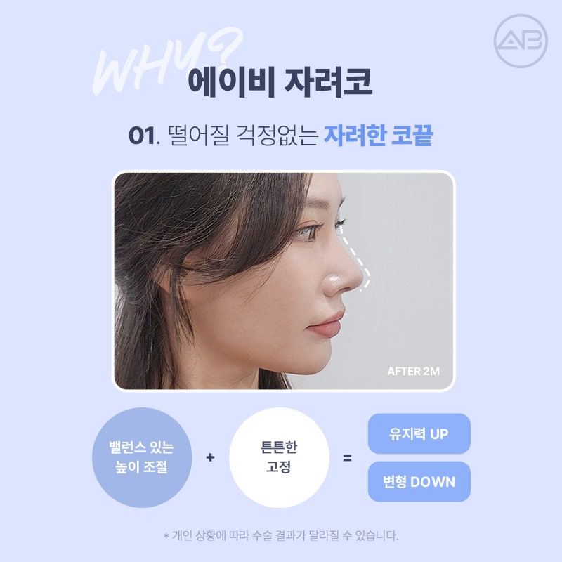 에이비성형외과 자려한코성형이란? 관련 이미지 4