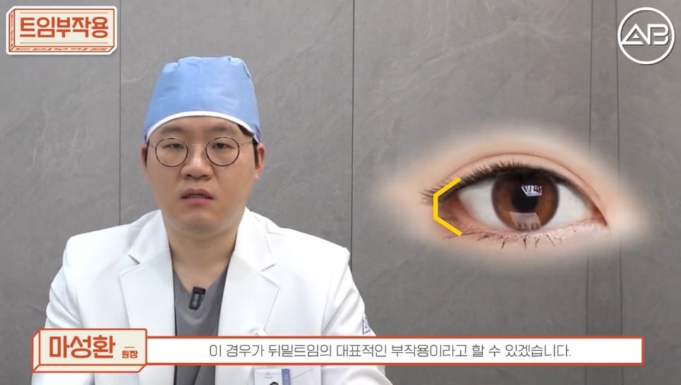 #에이비성형외과#에이비tv#눈성형#트임부작용 관련 이미지 5