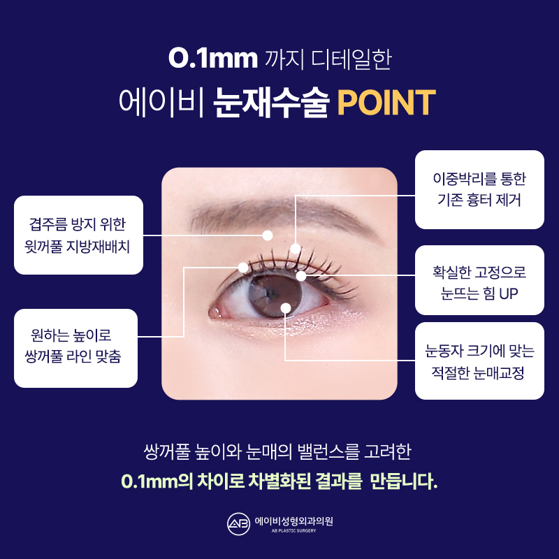 AB Revision Double Eyelid Surgery: What Is Double Folding? image 6