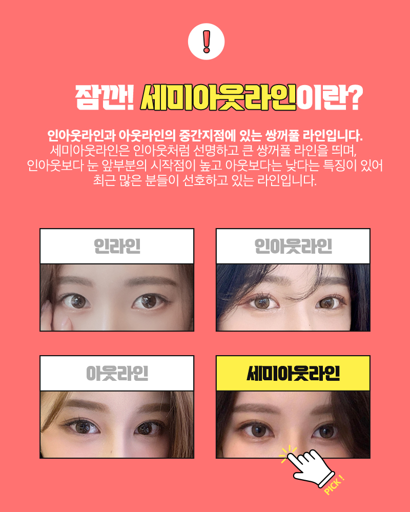 Experience Semi-Out Double Eyelid Surgery at AB Plastic Surgery image 2