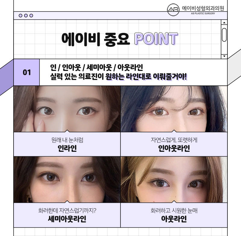 중학생쌍꺼풀수술 에이비라서 다르다 관련 이미지 3