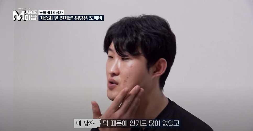 에이비성형외과 맥미남(MAKE미남) 4회 - 도깨비내남자 코수술 알아보기! 관련 이미지 6