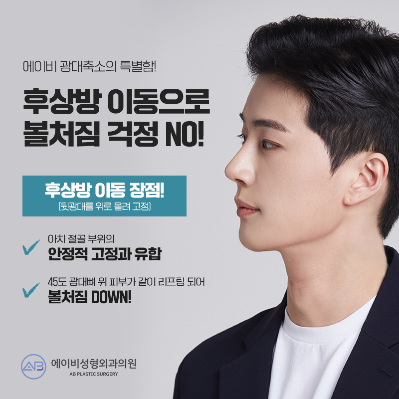 남자광대축소술 다르게 접근해야 관련 이미지 3