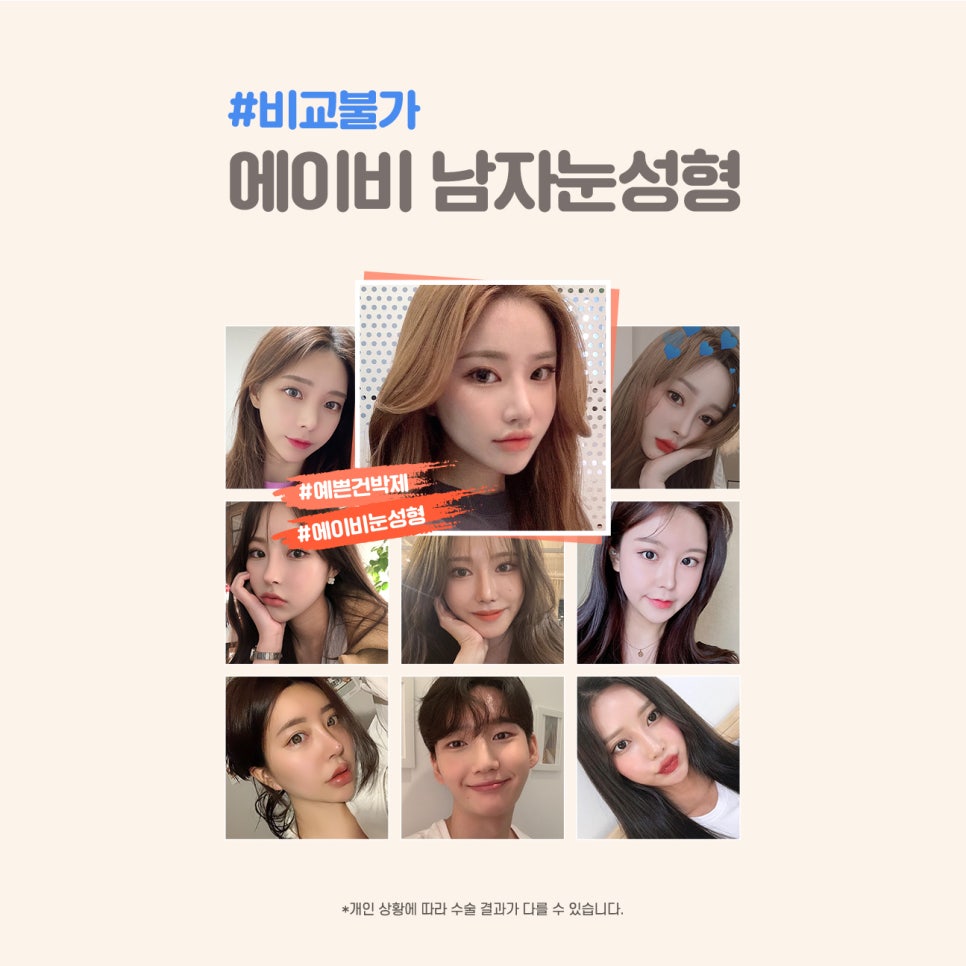 [칼럼] 쌍꺼풀 없이, 눈매교정만 할 수는 없나요? 관련 이미지 5