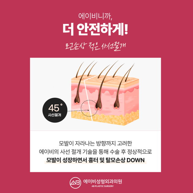 이마거상술가격 합리적으로 신중하게 선택하는 방법 관련 이미지 8
