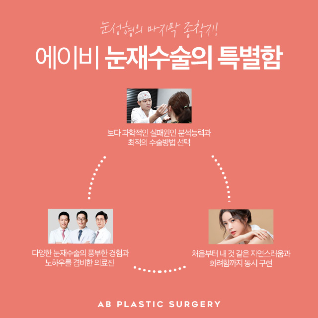 눈재수술잘하는곳 바로 에이비성형외과 관련 이미지 4