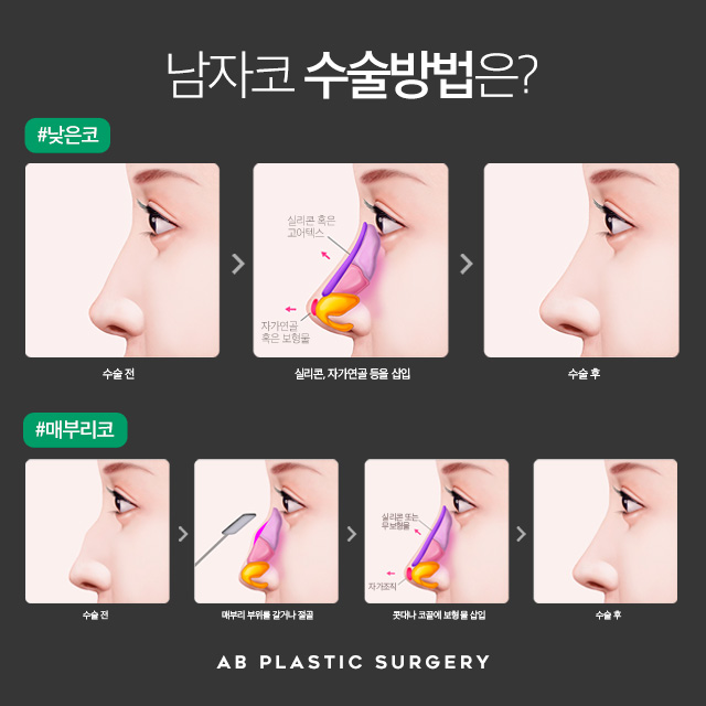 남자코성형 에이비와 함께라면 자신감 UP 관련 이미지 5