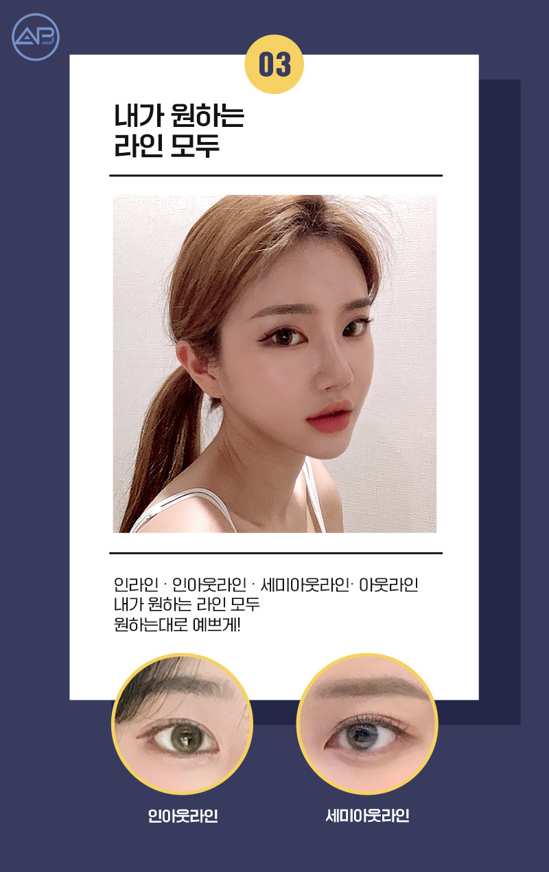 눈매교정수술후기 에이비성형외과에서 확인해 관련 이미지 5