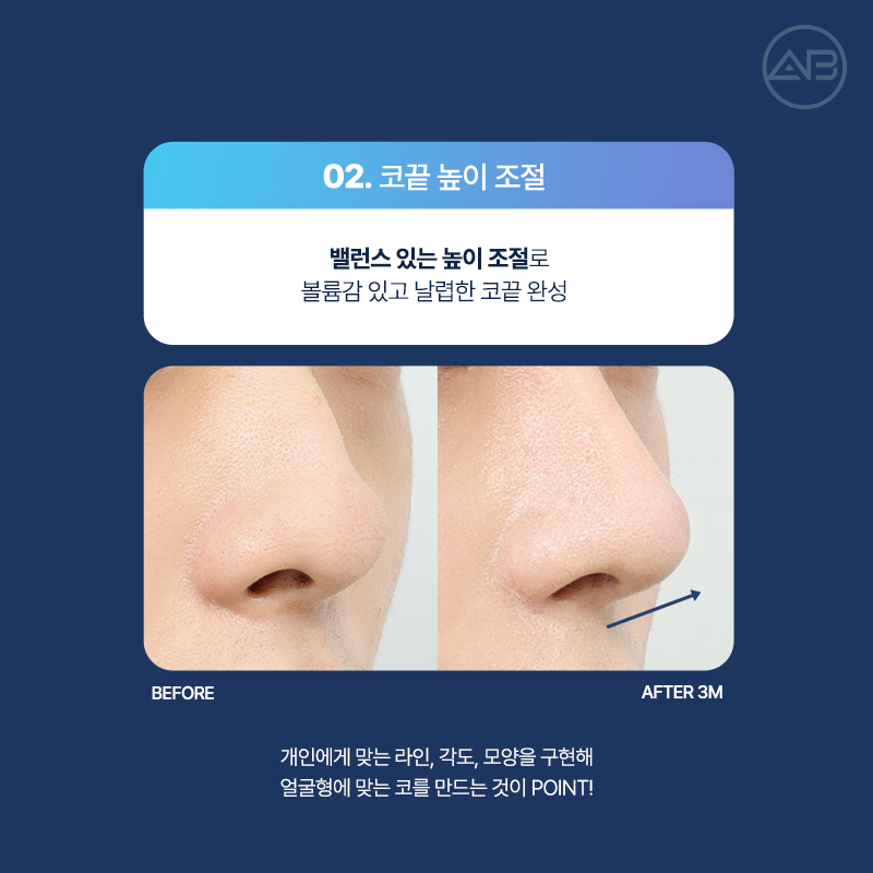 남자직선코성형 왜 에이비성형외과일까? 관련 이미지 6