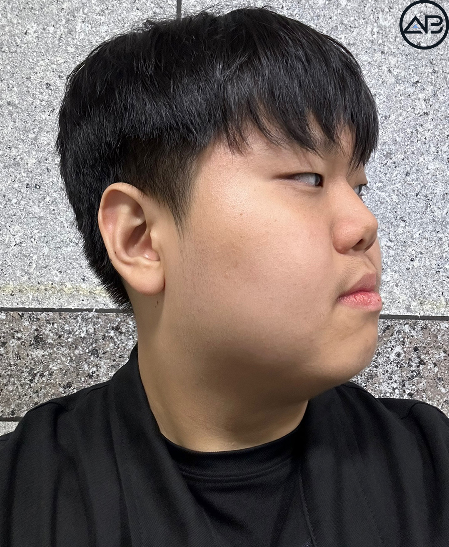 에이비성형외과 맥미남(MAKE미남) 방송이후 근황_가슴앓이내남자 관련 이미지 4