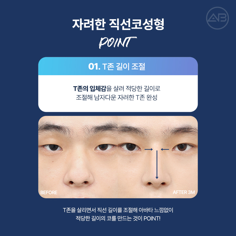 남자직선코성형 왜 에이비성형외과일까? 관련 이미지 5