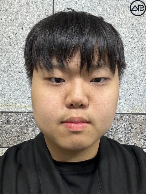 에이비성형외과 맥미남(MAKE미남) 방송이후 근황_가슴앓이내남자 관련 이미지 2