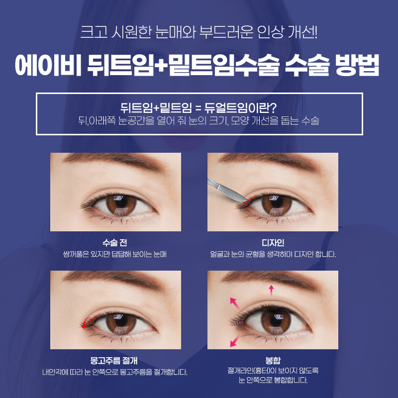 앞트임전후 달라짐을 느껴봐 관련 이미지 3