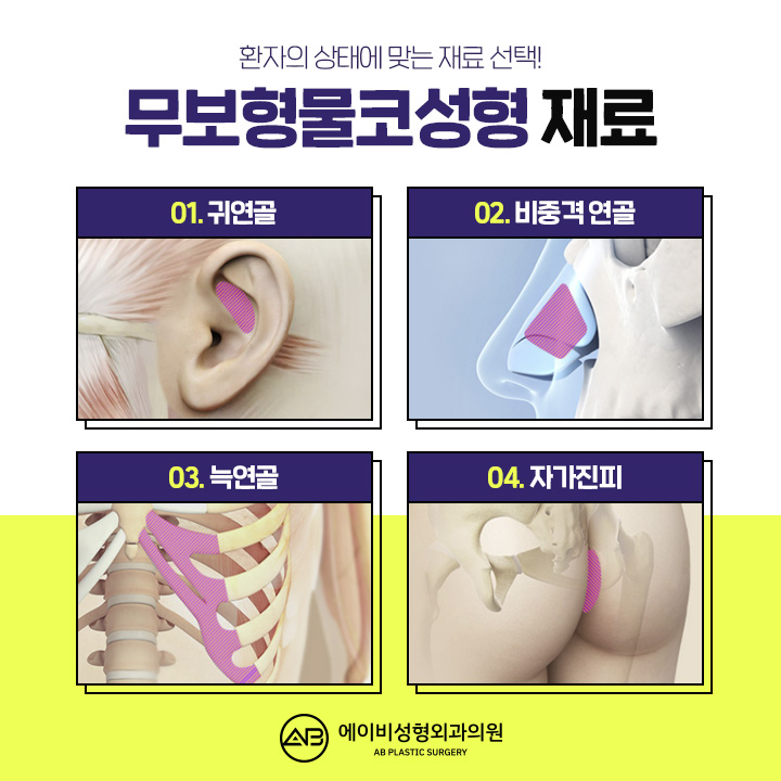 무보형물코수술 선택하고 싶다면 관련 이미지 3