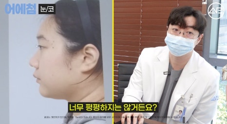 에이비성형외과 맥미걸(MAKEMEGirl) 맥미돌 코성형 상담 과정 관련 이미지 31