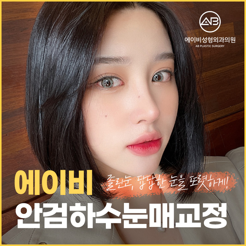 눈뜨는 힘이 부족하다면 에이비 안검하수눈매교정 관련 이미지 1
