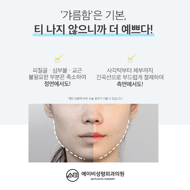 사각턱축소술 이래서 에이비다! 관련 이미지 6